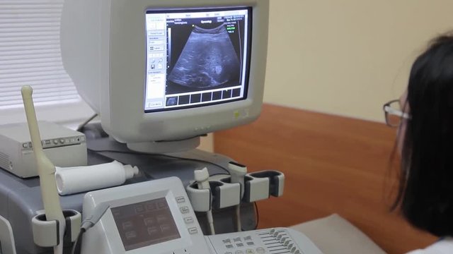 A female doctor is working behind an ultrasound diagnostic tool. Medical technologies. ultrasound device.4K