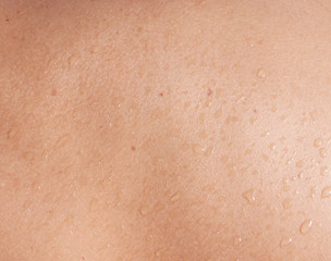 Wet skin