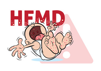 Crying baby with hand, foot and mouth disease or HFMD illustration