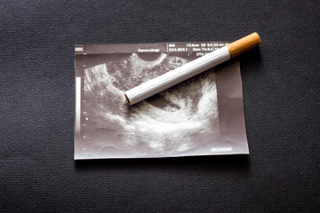 Cigarette on the picture of uzi pregnancy, pregnancy and smoking, smoke, gestation
