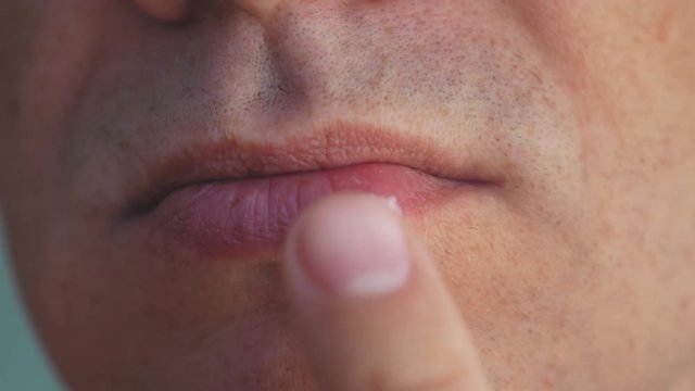 A young man with herpes on his lips.Herpes. Lip treatment. Close up. A man puts a cream on his lips. Viral disease.