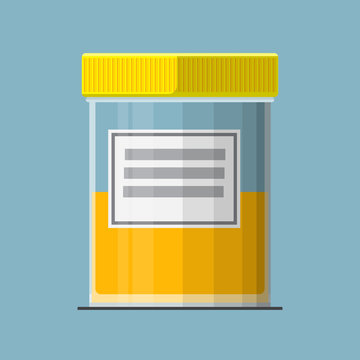 Urine Sample Vector Flat Design.
