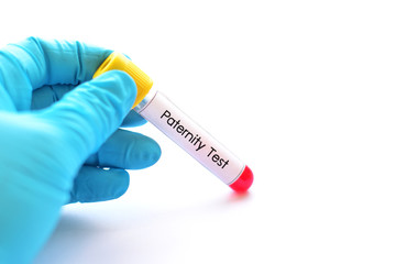 Obraz premium Test tube with blood sample for paternity test 
