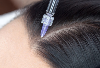 Procedure of mesotherapy. The doctor cosmetologist makes the procedure of mesotherapy in woman's head. Strengthen hair and their growth. - obrazy, fototapety, plakaty