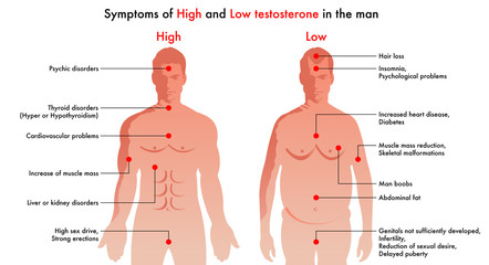 medical illustration of the symptoms and consequences in man to have a high level or a low level of testosterone - obrazy, fototapety, plakaty