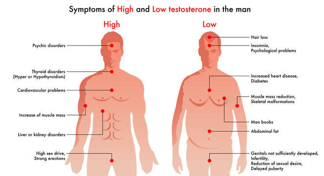 medical illustration of the symptoms and consequences in man to have a high level or a low level of testosterone