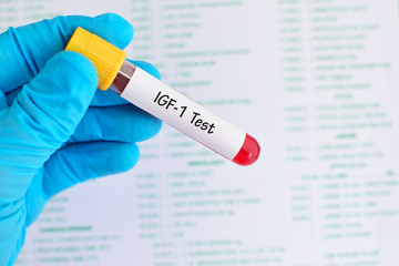 Blood sample tube for somatomedin C or insulin-like growth factor-1 (IGF-1) test
