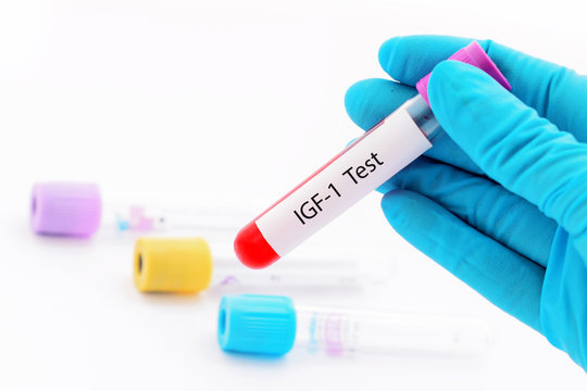 Blood sample tube for somatomedin C or insulin-like growth factor-1 (IGF-1) test
