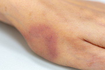 Fototapeta premium A physical of tissue, nerves, tendons at hand.