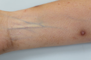 Fototapeta premium A physical of tissue, nerves, tendons at hand.
