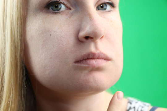 Teeth Problem. Gumboil, flux and swelling of the cheek. Closeup Of Beautiful Sad Girl Suffering From Strong Tooth Pain. Attractive Female Feeling Painful Toothache, Dental Health And Care Concept