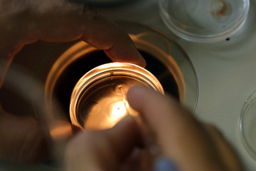 This images shows the process of 