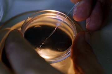 This images shows the process of "IVF".  After obtaining the mother's ovum and the sperm of father,the technician in the lab separates the mother’s ovum and inserts the sperm into it.