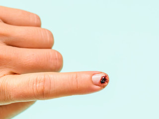Knife-damaged index finger of the left female hand on a light blue background.