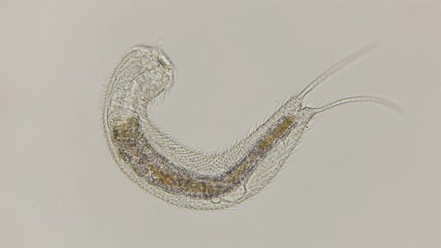Abdominal worm Gastrotricha under the microscope