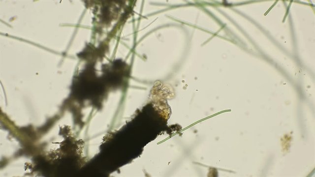 rotifer Floscularia ringens filters water by rotating its cilia, under a microscope filters water by rotating its cilia, under a microscope