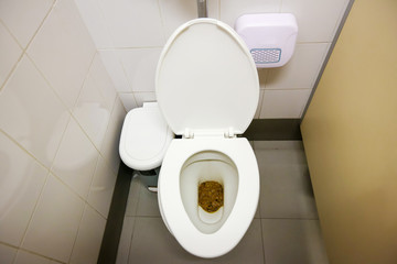 Feces in public toilet, Users who forget to flush the toilet.Dirty toilet in a house.Dirty old...