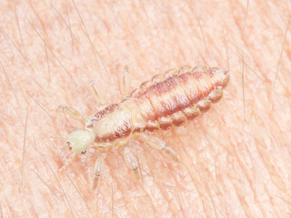 3d rendered medically accurate illustration of a head louse on human skin