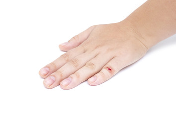 female's hand with wound on finger on white background