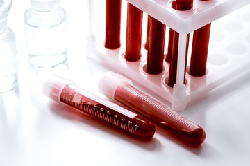 glass tubes with blood sample in stand no one