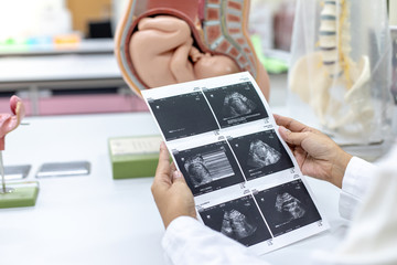 Ultrasound of baby in pregnant woman, Doctor reading test results of pregnant woman by ultrasound.