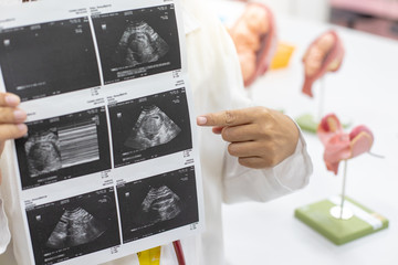 Ultrasound of baby in pregnant woman, Doctor reading test results of pregnant woman by ultrasound.
