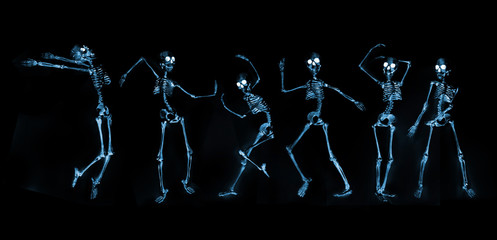 Dancing Skeletons X ray