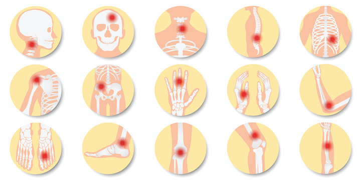 Disease of the joints and bones icon set on white background