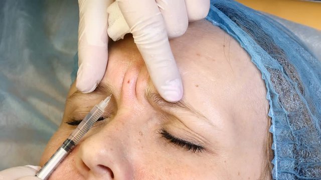 Face skin lifting injections. Beautician making botox injections. glabellar frown line care. Female face rejuvenation. 4k