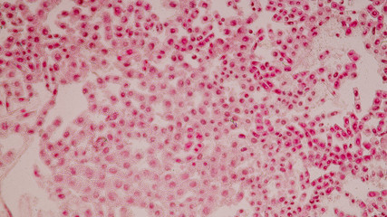 Root tip of Onion and Mitosis cell in the Root tip of Onion with dye extracts in glutinous rice under a microscope.