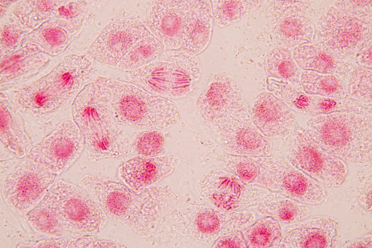 Root tip of Onion and Mitosis cell in the Root tip of Onion with dye extracts in glutinous rice under a microscope.