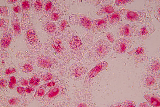 Root tip of Onion and Mitosis cell in the Root tip of Onion with dye extracts in glutinous rice under a microscope.