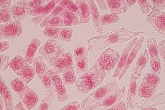 Root tip of Onion and Mitosis cell in the Root tip of Onion with dye extracts in glutinous rice under a microscope.