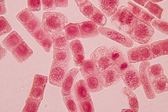 Root tip of Onion and Mitosis cell in the Root tip of Onion with dye extracts in glutinous rice under a microscope.