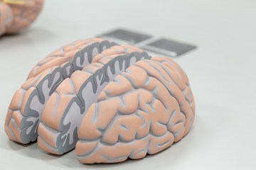 Human brain model for education in laboratory.