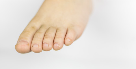 Dirty feet of a little boy's feet. Dirt under the fingernails. On a white background.