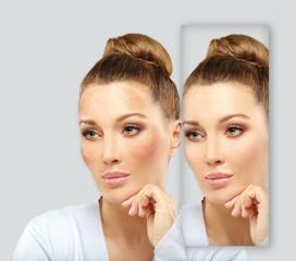 Dark spots, freckles,hyperpigmentation(melasma or chloasma)