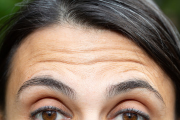 Forehead wrinkles close up