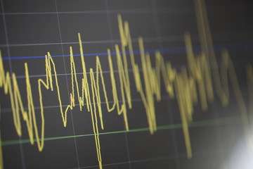 Charts of financial instruments with analysis for professional technical analysis on the monitor of a computer. Fundamental and technical analysis concept.