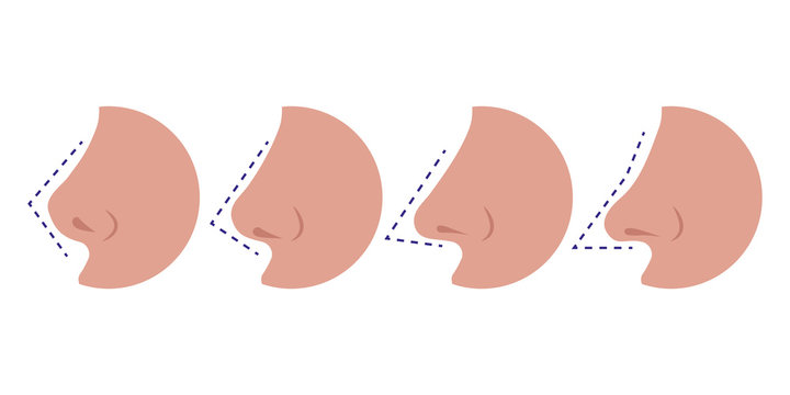 Vector Illustration Different Types Female Noses