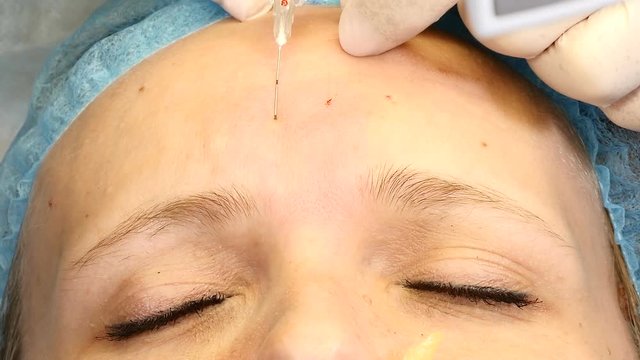 Close up of beautician hands on female client face. doctor holds a syringe with cannula needle. Face lifting concept.4k