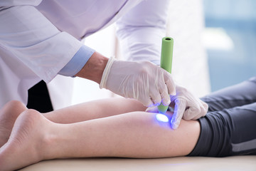 Patient in clinic undergoing laser scar removal