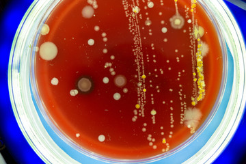 Petri dish with colonies of microbes