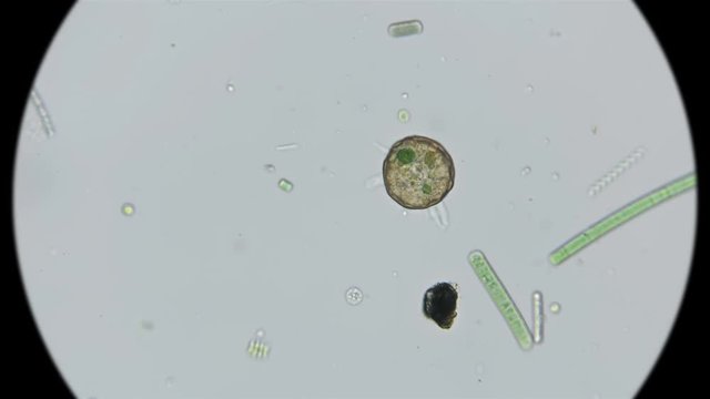 testate amoeba Arcella gibbosa under the microscope