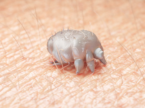 3d rendered medically accurate illustration of a scabies mite on human skin