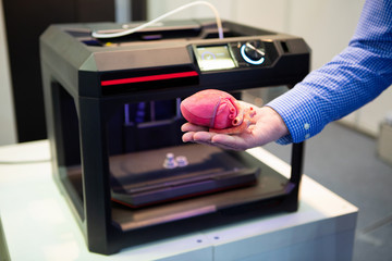 The cardiosurgeon demonstrates the heart printed on a 3d printer