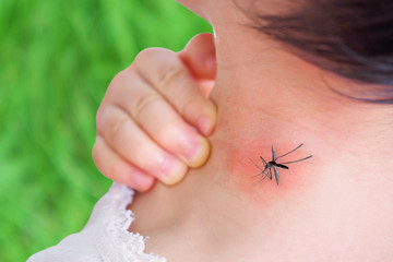 cute asian baby girl has rash and allergy on neck skin from mosquito bite and sucking blood while playing outdoor