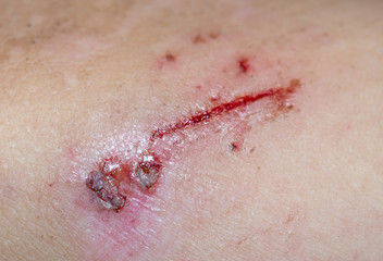 Wound on the skin of a macro