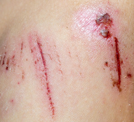 Wound on the skin of a macro