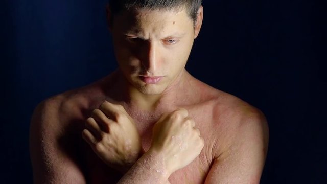 young man with skin covered psoriasis patches is crossing hands on his chest, dramatic shot